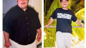 Facing Gastric Bypass Surgery...Does Nutrition Really Make A Difference?