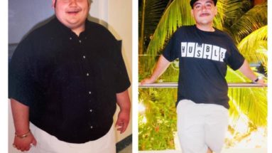 Facing Gastric Bypass Surgery...Does Nutrition Really Make A Difference?